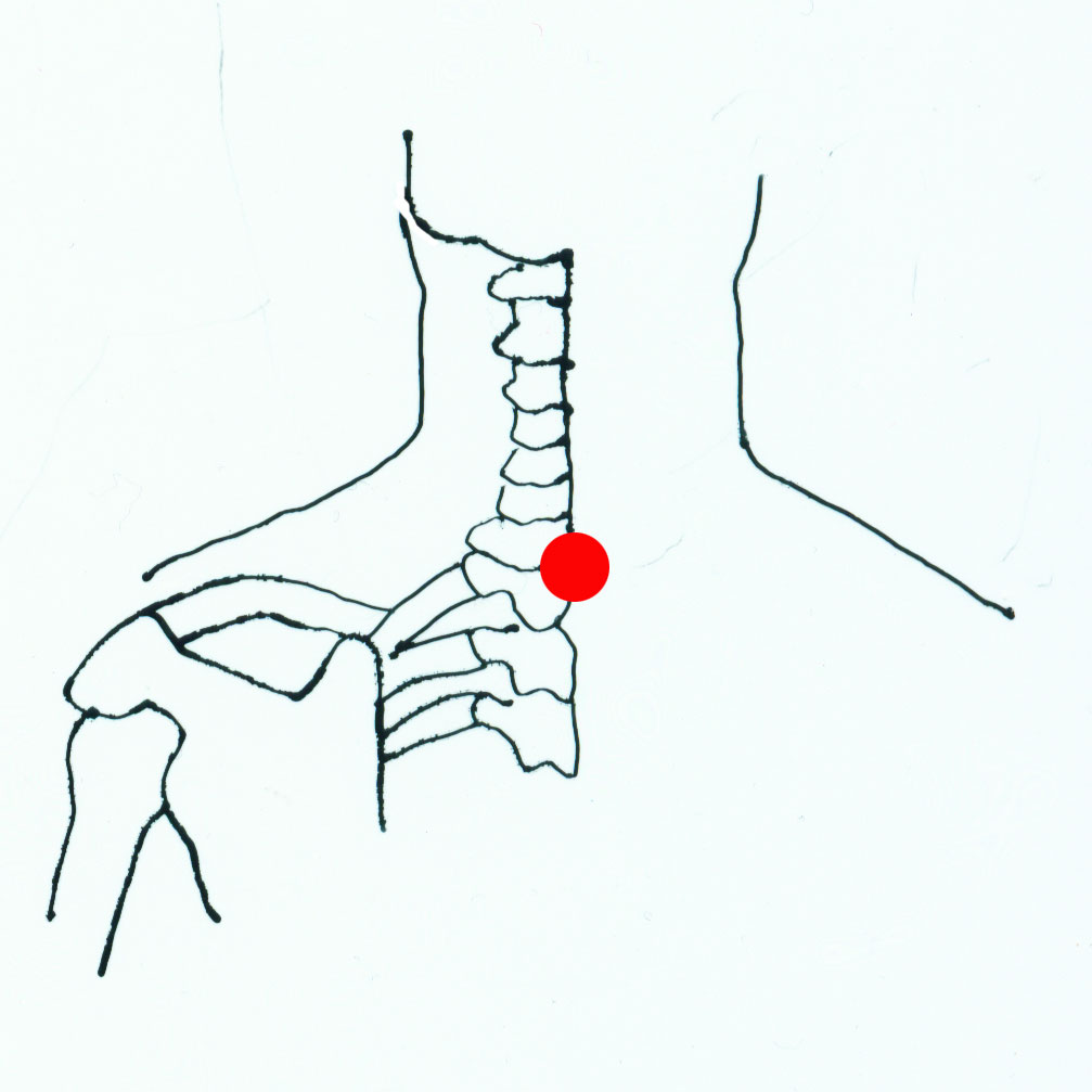 daz hui - acupuncture point picture